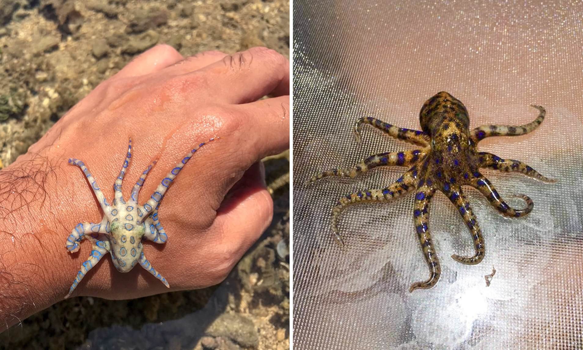 What It’s Like to Be Nearly Killed by a BlueRinged Octopus’ Venom